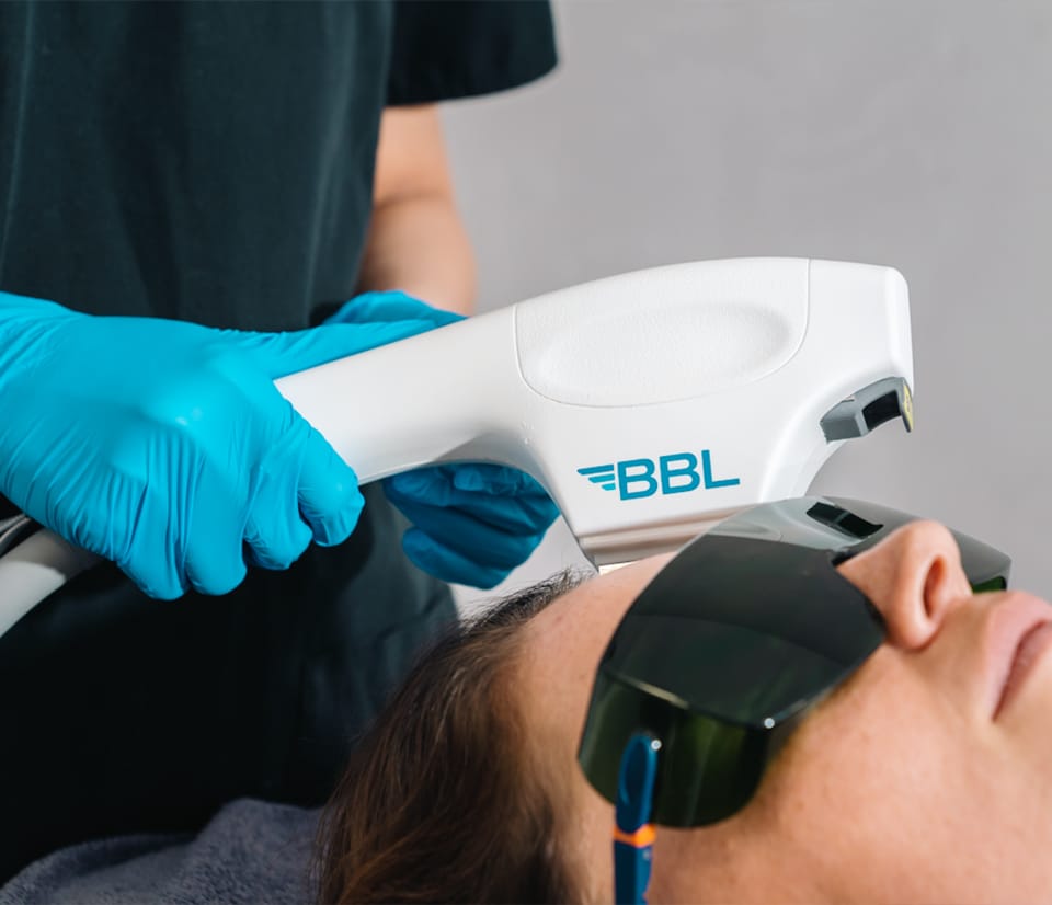 Broad Band Light (BBL) Sciton skincare treatment provides lasting skin improvement, leaving you with glowing, youthful skin and renewed confidence.